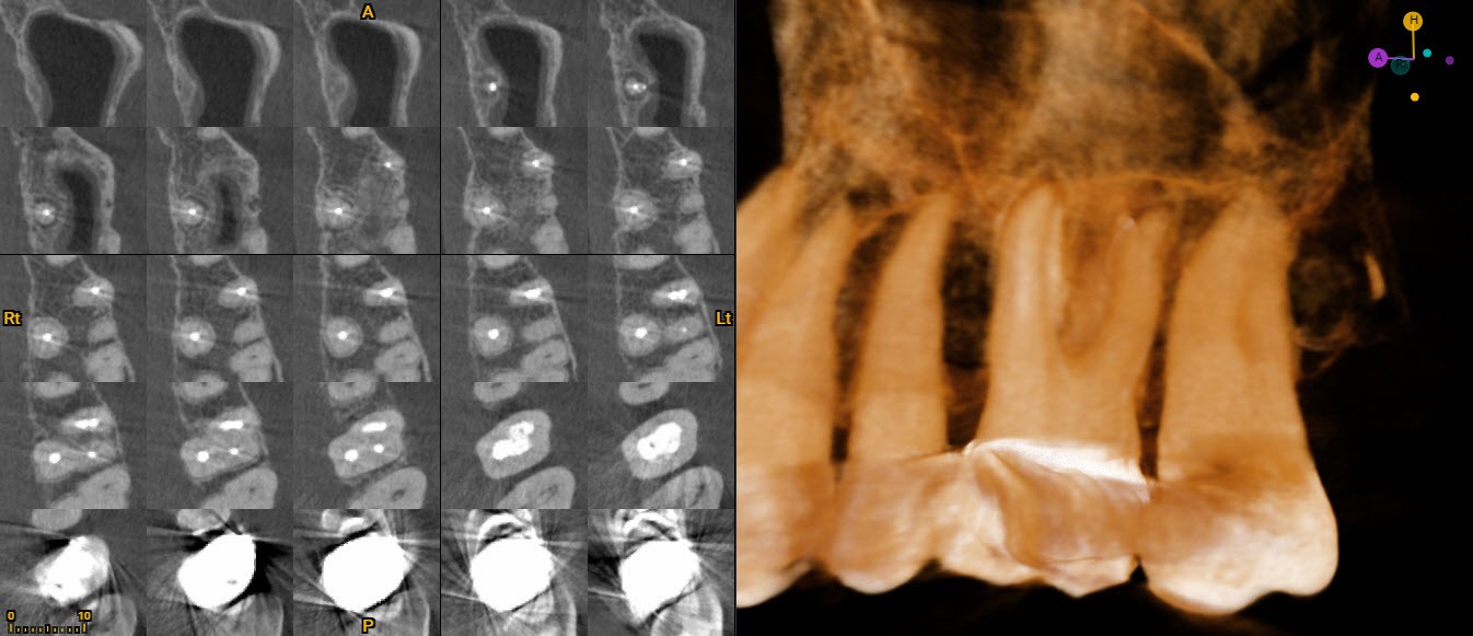 3d-dental-imaging-cbct-caomr